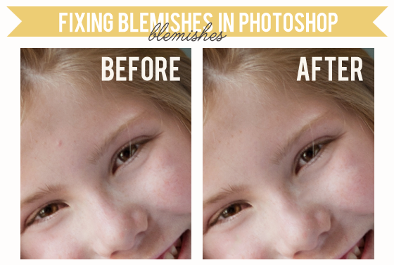 Fixing Photo Blemishes in Photoshop